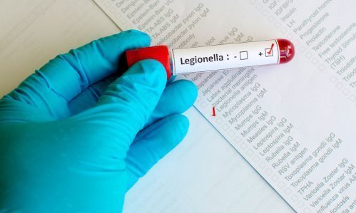 LEGIONELLA