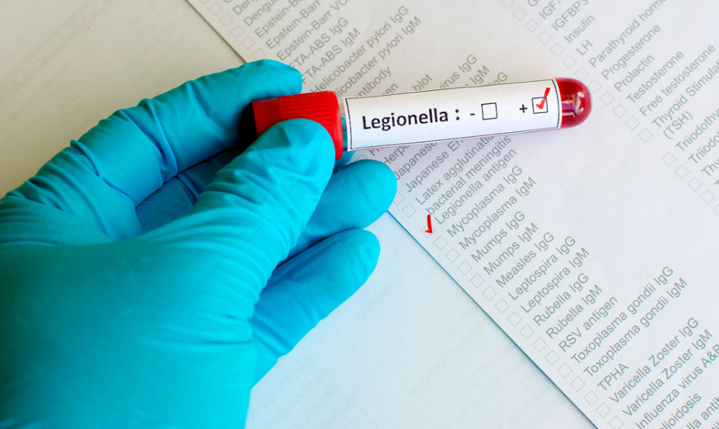 LEGIONELLA